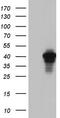 AKAP-7 isoform gamma antibody, M07387, Boster Biological Technology, Western Blot image 