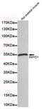 SET And MYND Domain Containing 1 antibody, TA347053, Origene, Western Blot image 