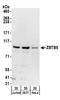 Zinc Finger And BTB Domain Containing 5 antibody, A304-062A, Bethyl Labs, Western Blot image 