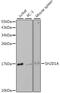 SH2 Domain Containing 1A antibody, GTX54727, GeneTex, Western Blot image 