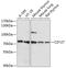 Interleukin 7 Receptor antibody, A02222-2, Boster Biological Technology, Western Blot image 