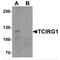 T Cell Immune Regulator 1, ATPase H+ Transporting V0 Subunit A3 antibody, MBS150138, MyBioSource, Western Blot image 