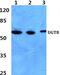 UDP Glycosyltransferase 8 antibody, PA5-37282, Invitrogen Antibodies, Western Blot image 
