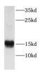CXXC Repeat Containing Interactor Of PDZ3 Domain antibody, FNab01978, FineTest, Western Blot image 