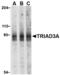 Ring Finger Protein 216 antibody, TA306182, Origene, Western Blot image 