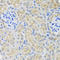 Sulfotransferase Family 1A Member 1 antibody, LS-C331573, Lifespan Biosciences, Immunohistochemistry paraffin image 
