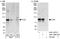 Tousled Like Kinase 2 antibody, A301-257A, Bethyl Labs, Immunoprecipitation image 
