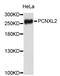 Pecanex 2 antibody, abx002528, Abbexa, Western Blot image 