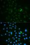 CD79b Molecule antibody, LS-C331842, Lifespan Biosciences, Immunofluorescence image 