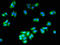 HAD antibody, LS-C669607, Lifespan Biosciences, Immunofluorescence image 