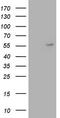 Angiopoietin 1 antibody, LS-C791142, Lifespan Biosciences, Western Blot image 