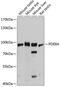 High affinity cAMP-specific and IBMX-insensitive 3 ,5 -cyclic phosphodiesterase 8A antibody, 14-301, ProSci, Western Blot image 