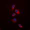 TNF Receptor Superfamily Member 11b antibody, orb216171, Biorbyt, Immunocytochemistry image 