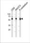 AMPK antibody, TA328197, Origene, Western Blot image 
