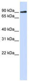 DNA Cross-Link Repair 1C antibody, TA339872, Origene, Western Blot image 
