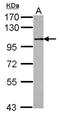 Serine/threonine-protein phosphatase 4 regulatory subunit 1 antibody, NBP2-19913, Novus Biologicals, Western Blot image 