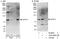 SRY-Box 13 antibody, A303-095A, Bethyl Labs, Western Blot image 