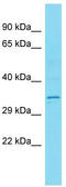 Cancer/Testis Antigen Family 47 Member B1 antibody, TA335891, Origene, Western Blot image 