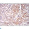 BLNK antibody, LS-C812514, Lifespan Biosciences, Immunohistochemistry paraffin image 