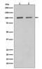 SATB Homeobox 1 antibody, M01312, Boster Biological Technology, Western Blot image 