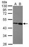 Zinc Finger And BTB Domain Containing 26 antibody, NBP2-20937, Novus Biologicals, Western Blot image 