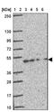CAMP Responsive Element Binding Protein 3 Like 3 antibody, NBP2-38785, Novus Biologicals, Western Blot image 