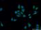Dedicator Of Cytokinesis 1 antibody, 23421-1-AP, Proteintech Group, Immunofluorescence image 