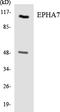 EPH Receptor A7 antibody, LS-C291933, Lifespan Biosciences, Western Blot image 