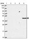 Protein naked cuticle homolog 2 antibody, PA5-61979, Invitrogen Antibodies, Western Blot image 