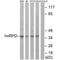 Heterogeneous nuclear ribonucleoprotein D0 antibody, MBS9413782, MyBioSource, Western Blot image 