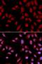 DLG Associated Protein 5 antibody, orb136668, Biorbyt, Immunofluorescence image 
