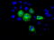 Sterol O-acyltransferase 2 antibody, TA501225, Origene, Immunofluorescence image 