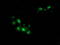 Beta-Transducin Repeat Containing E3 Ubiquitin Protein Ligase antibody, TA502524, Origene, Immunofluorescence image 