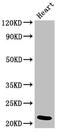 NADH:Ubiquinone Oxidoreductase Subunit B9 antibody, LS-C672180, Lifespan Biosciences, Western Blot image 