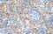 Armadillo Repeat Containing X-Linked 6 antibody, PA5-42600, Invitrogen Antibodies, Immunohistochemistry paraffin image 