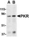 Interferon-induced, double-stranded RNA-activated protein kinase antibody, TA306357, Origene, Western Blot image 