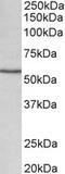 Cytochrome P450 Family 1 Subfamily A Member 1 antibody, TA309533, Origene, Western Blot image 