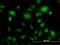 Ubiquitin Specific Peptidase 34 antibody, H00009736-M01, Novus Biologicals, Immunocytochemistry image 