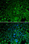 Crystallin Alpha A antibody, 19-816, ProSci, Immunofluorescence image 