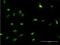 Distal-Less Homeobox 3 antibody, H00001747-M09, Novus Biologicals, Immunocytochemistry image 