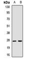 N(Alpha)-Acetyltransferase 60, NatF Catalytic Subunit antibody, LS-C668880, Lifespan Biosciences, Western Blot image 