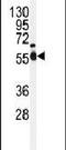 NIMA Related Kinase 2 antibody, PA5-15338, Invitrogen Antibodies, Western Blot image 