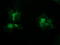 STK38L antibody, M06774, Boster Biological Technology, Immunofluorescence image 