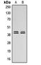 Mitogen-Activated Protein Kinase 1 antibody, orb315598, Biorbyt, Western Blot image 