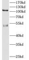 Calcium/Calmodulin Dependent Serine Protein Kinase antibody, FNab01283, FineTest, Western Blot image 