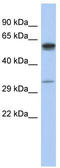Zinc Finger DHHC-Type Containing 24 antibody, TA333309, Origene, Western Blot image 