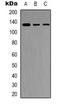 Janus Kinase 2 antibody, orb318917, Biorbyt, Western Blot image 