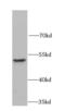 MHC Class I Polypeptide-Related Sequence A antibody, FNab05176, FineTest, Western Blot image 