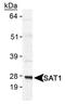 Spermidine/Spermine N1-Acetyltransferase 1 antibody, PA1-16992, Invitrogen Antibodies, Western Blot image 