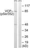Valosin Containing Protein antibody, LS-C199716, Lifespan Biosciences, Western Blot image 